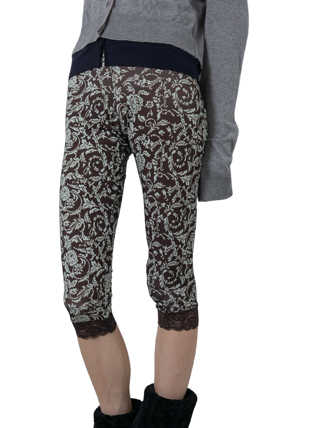 Lace-Trim Mid-Calf Shorts 